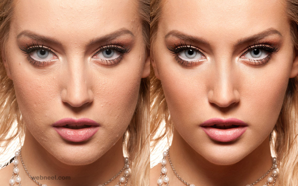 26-skin-photo-retouching-after-before.jpg