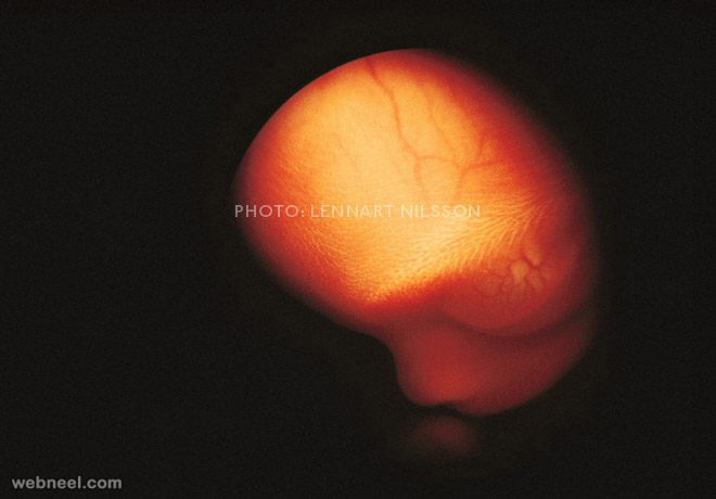 embryo 16weeks photo