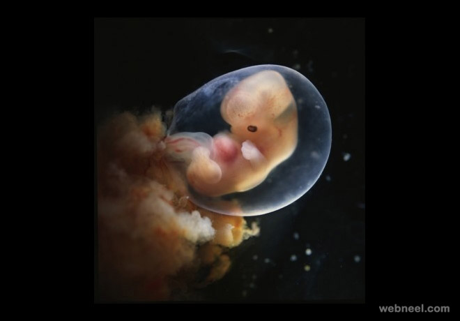 embryo 7weeks photo by lennart nilsson