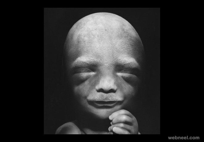 embryo 20weeks photo by lennart nilsson