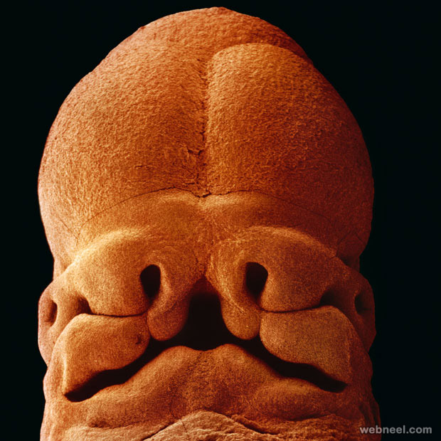 embryo 5weeks photo by lennart nilsson