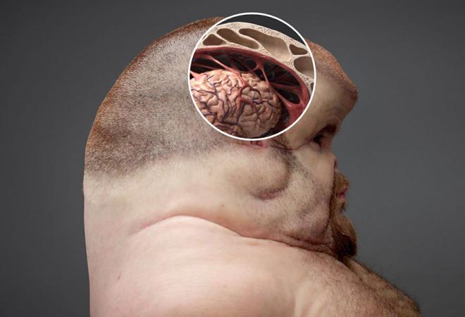 graham brain sculpture