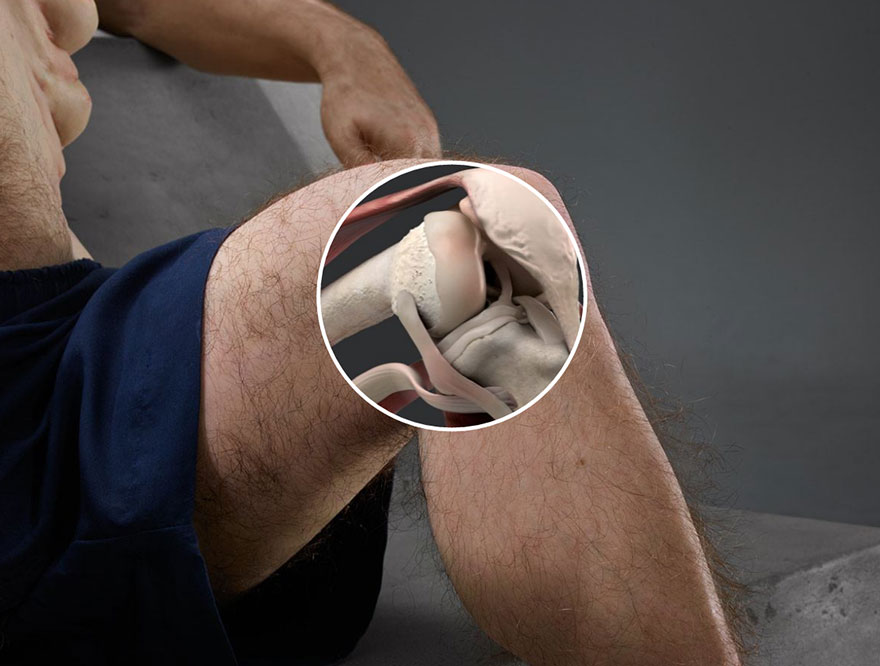 graham knees sculpture